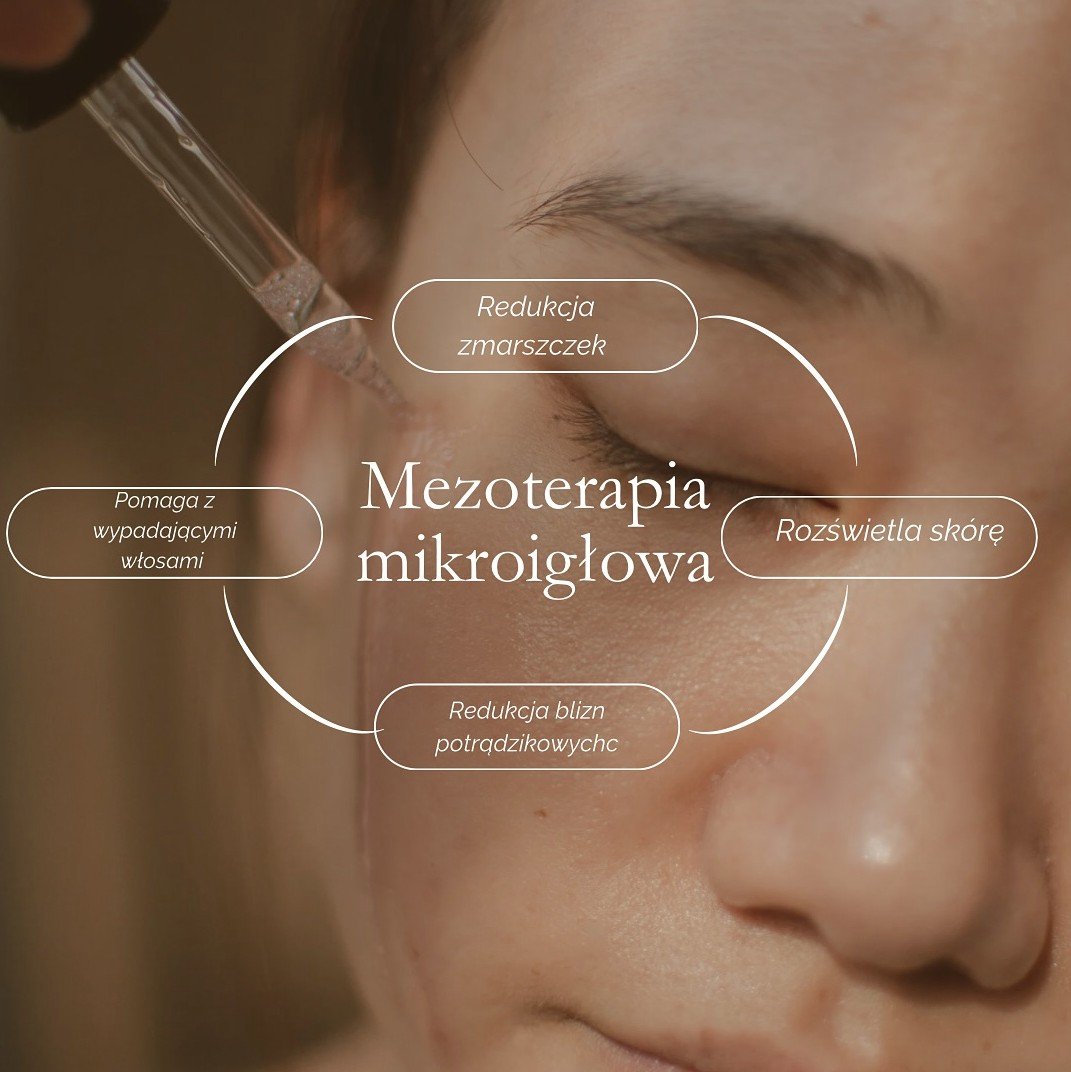 Mezoterapia mikroigłowa Sakura Beauty Wrocław