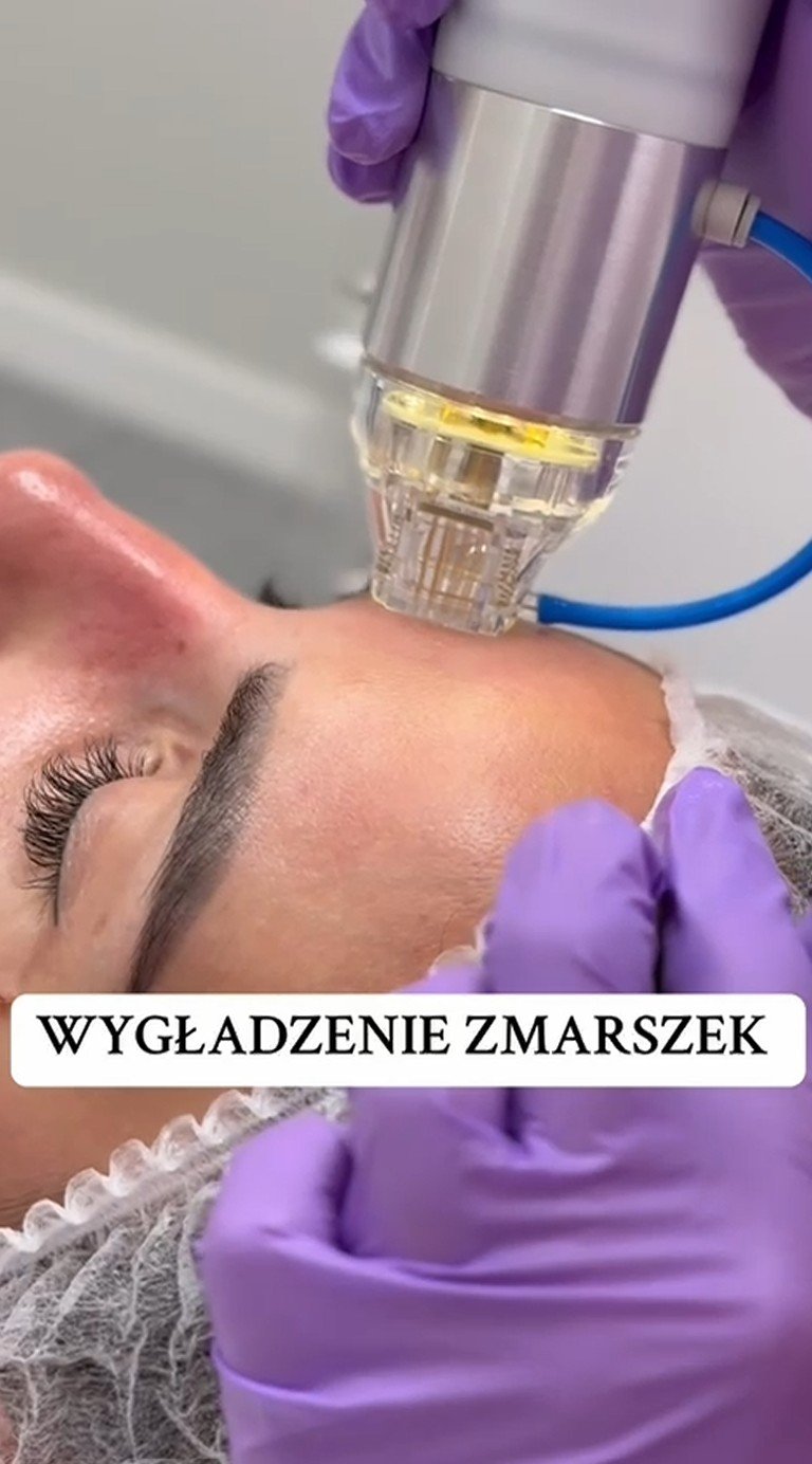 Redukcja zmarszczek w Sakura Beauty