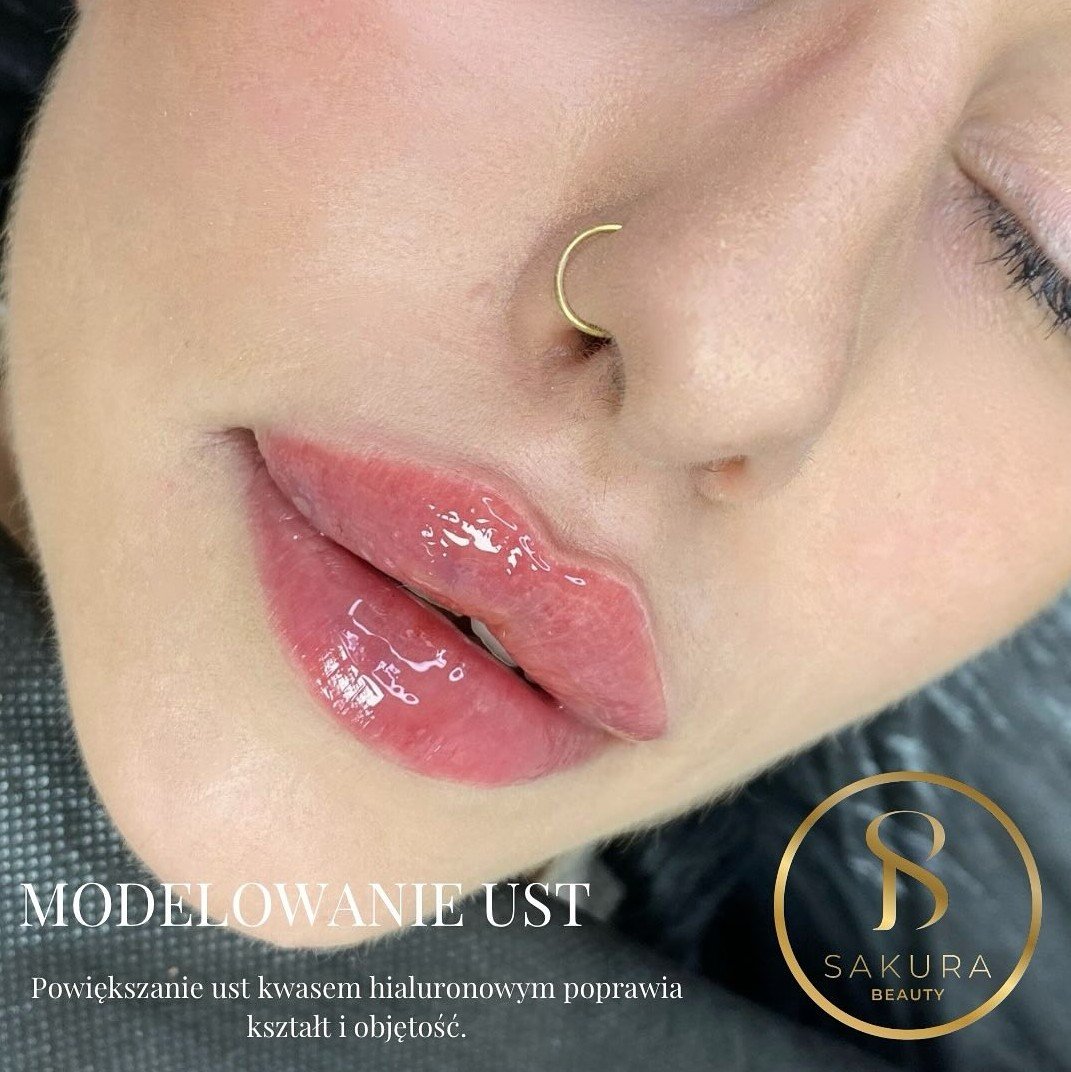 Medycyna estetyczna w Sakura Beauty